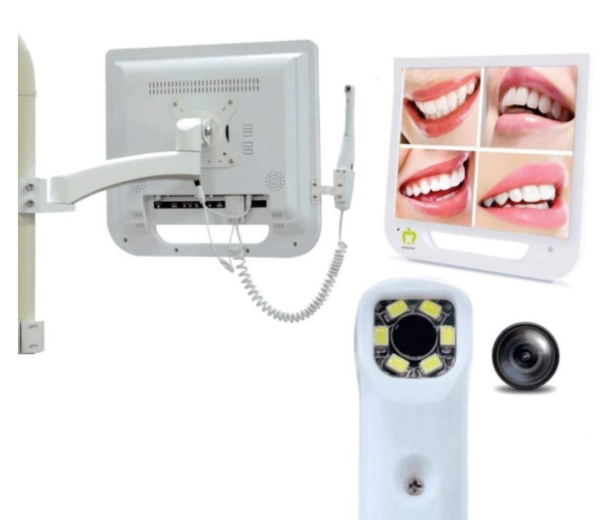 Caméra Intra-Orale HD | Communication et Diagnostic Dentaire